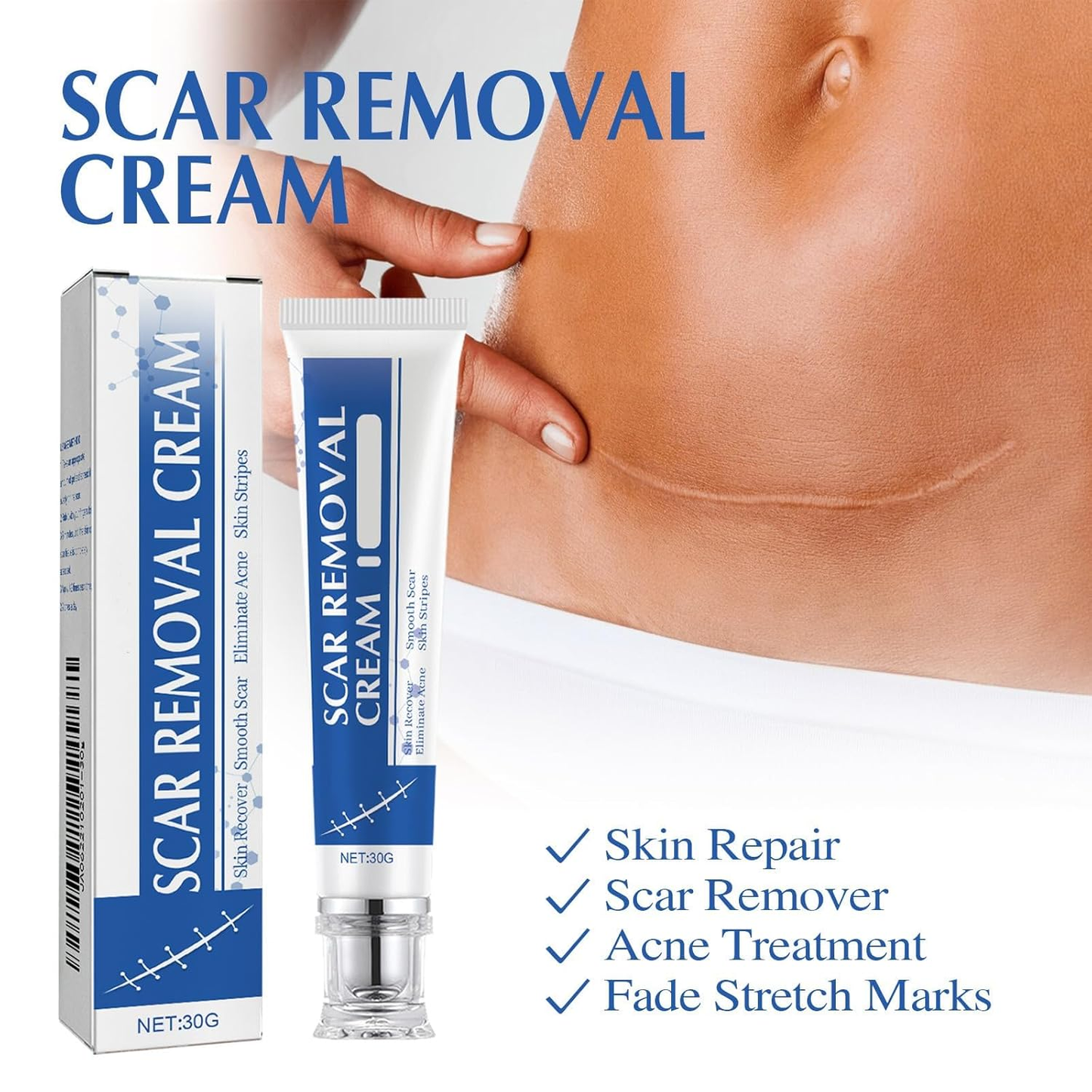 🩹 Alcuras® Medical Grade Silicone Scar Cream – Smooth Scars Fast!
