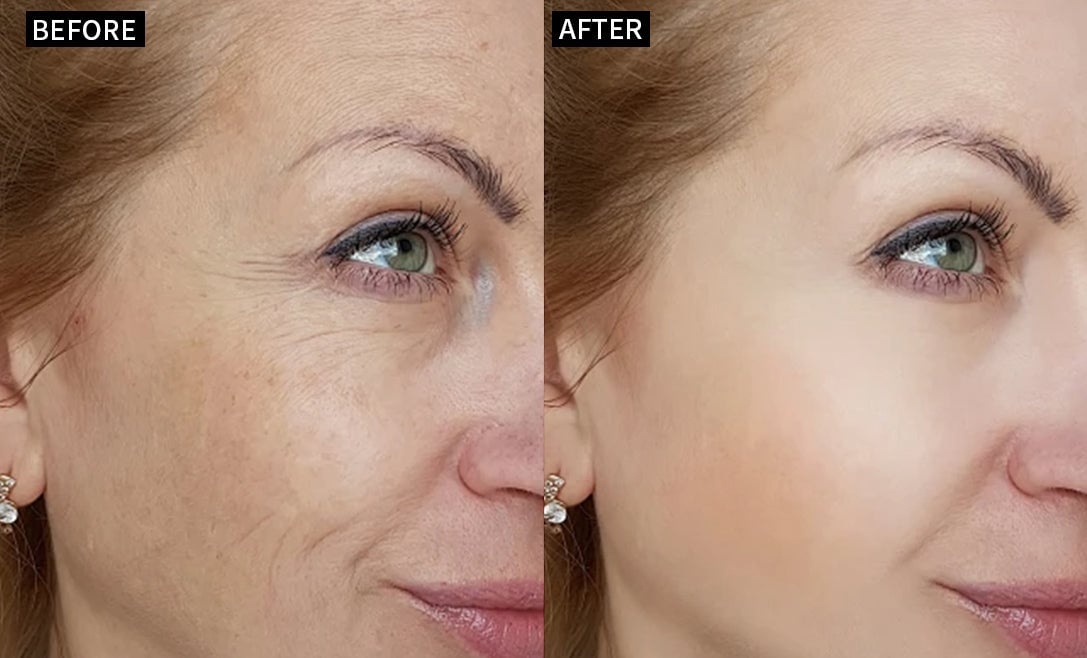 🔥Last Day 69% OFF-Alcuras® Anti-Wrinkle Face Cream🌿